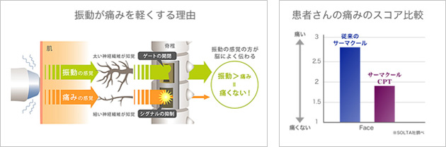 サーマクールCPTの特徴