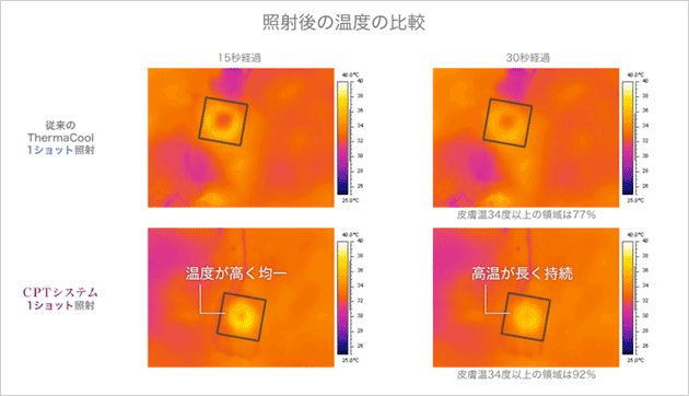 サーマクールCPTの特徴