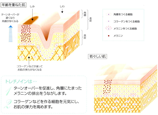 メディカルコスメ