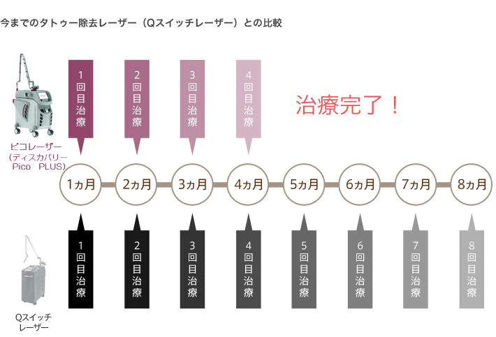 タトゥー除去ピコレーザーの特徴